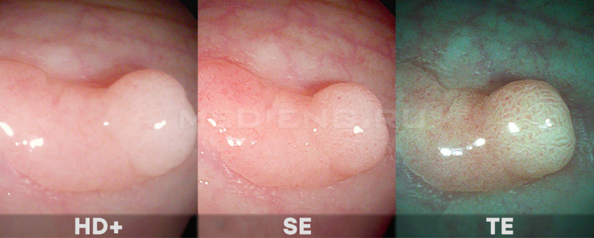 i-scan_hd_se_te