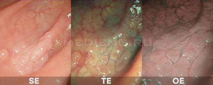 i-scan_se_te_oe