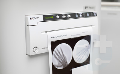 Медицинский УЗИ принтер Sony UP-971AD
